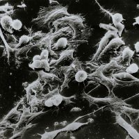 Prävention von Krebs